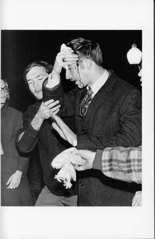 A white man with blood dripping down his face holds a bandage to his head. He is helped by another man with other people in the background. 